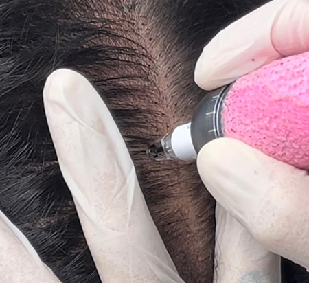 ヘアルプデザインイメージ写真