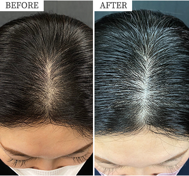 ビフォーアフターイメージ写真