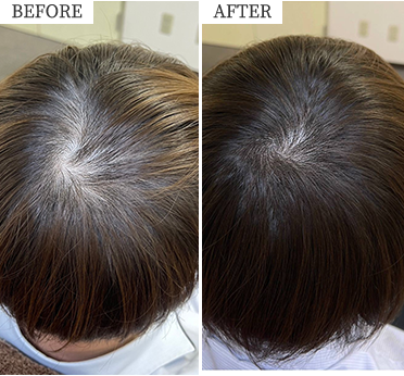 ビフォーアフターイメージ写真