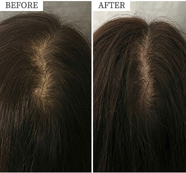 ビフォーアフターイメージ写真