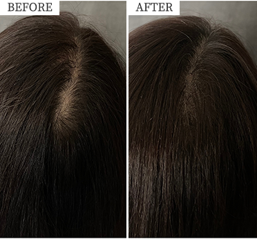 ビフォーアフターイメージ写真