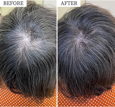 ビフォーアフターイメージ写真